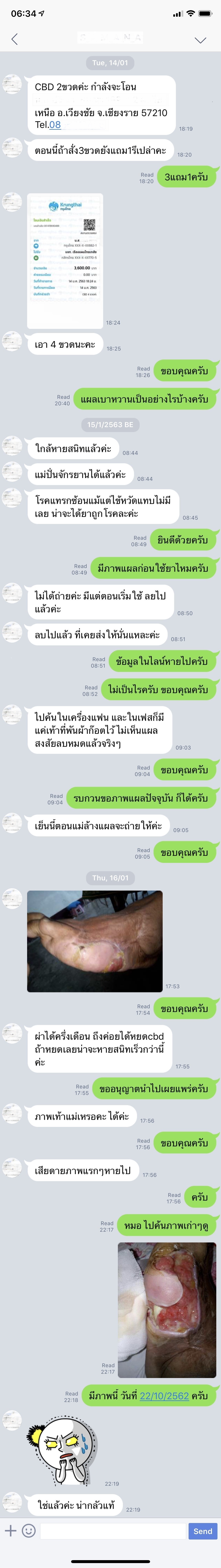 แผลเบาหวาน